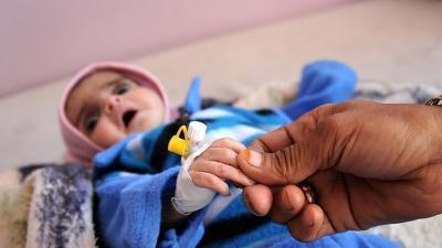 منظمة دولية: ربع المصابين بالكوليرا في اليمن أطفال دون الخامسة	 