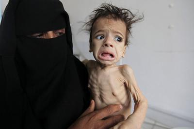 برنامج الأغذية: 240 ألف يمني يعانون المجاعة	 