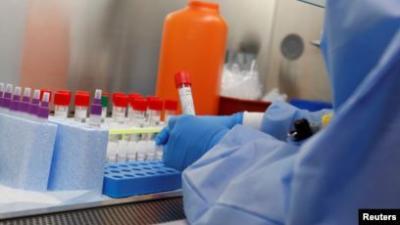 اختبار 69 عقاراً لإيجاد علاج لفيروس كورونا	 